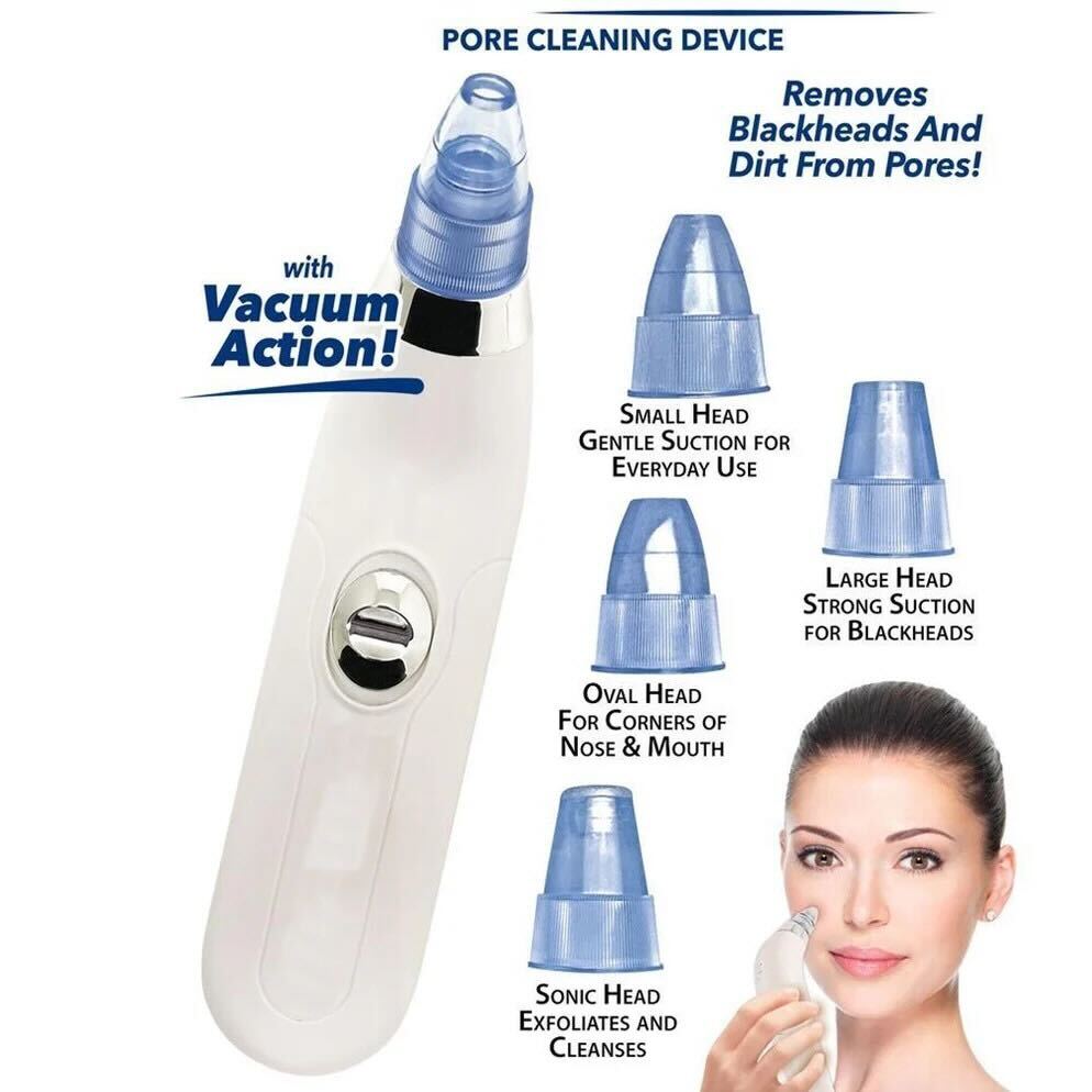 4-in-1 Pore Vacuum Cleaner – Blackhead Remover & Skin Exfoliator